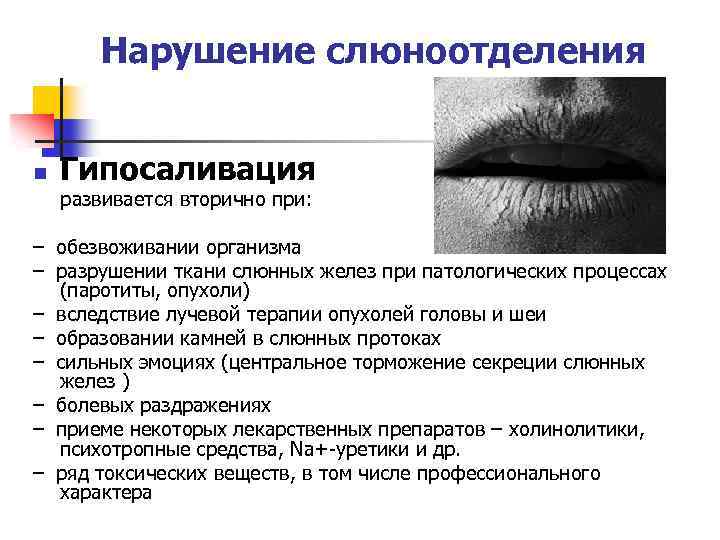Почему во сне текут слюни: 10 объяснений + 5 методов борьбы
