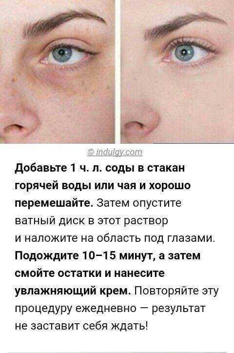 Синяк не проходит: причины и техника лечения