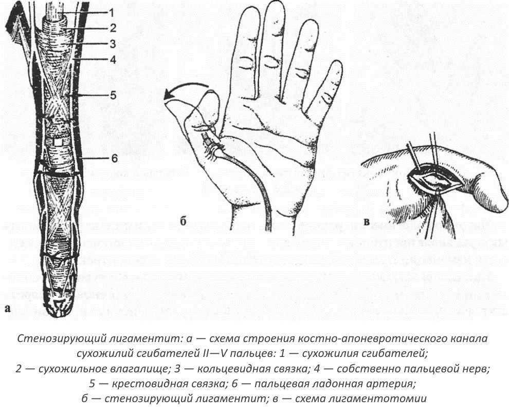 Почему нельзя щелкать пальцами на руках?