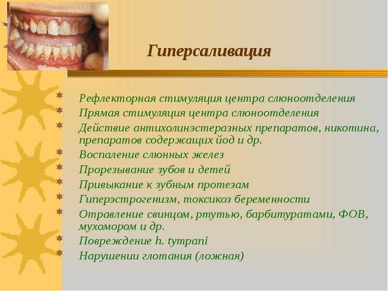 Сиалозы (гиперсаливация, гипосаливация, болезнь микулича, синдром шегрена)